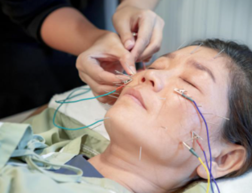 Putting Your Best Face Forward with Facial Acupuncture