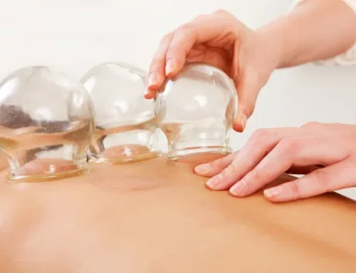 Essentials of Acupuncture and Cupping Therapy
