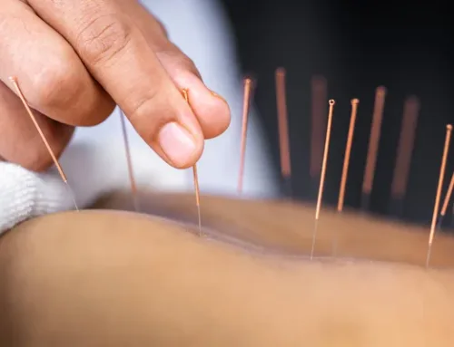 Five Perks of Regular Acupuncture Therapy