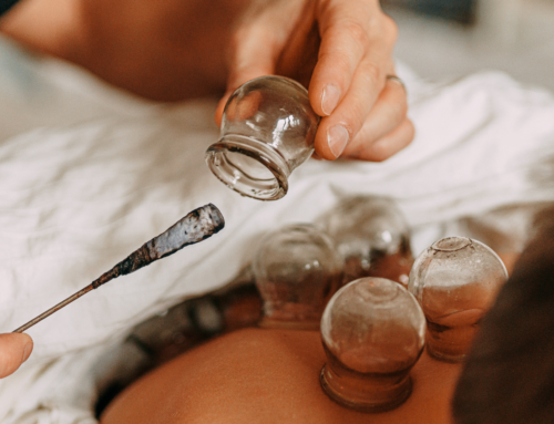 The Basics of Acupuncture & Cupping