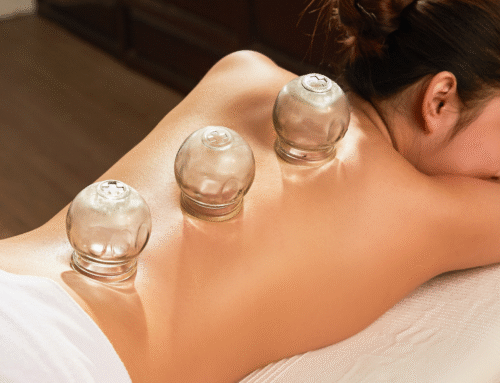 The Science Behind Cupping Therapy Explained